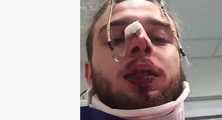 Σοκ στο μετρό του Τορόντο, τρένο χτυπά άνθρωπο στην αποβάθρα (βίντεο)